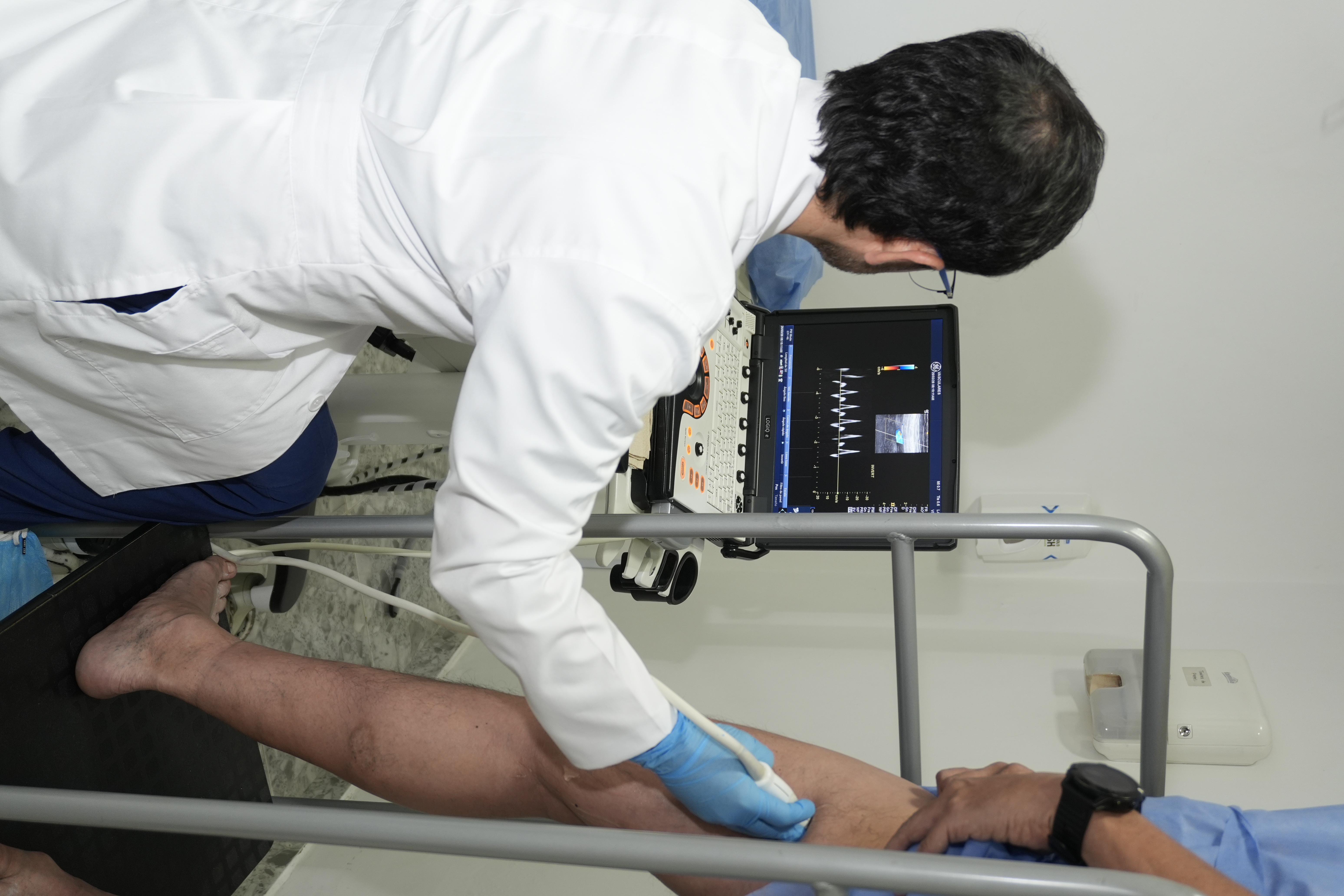 Equipo de ecografía vascular durante un estudio arterial