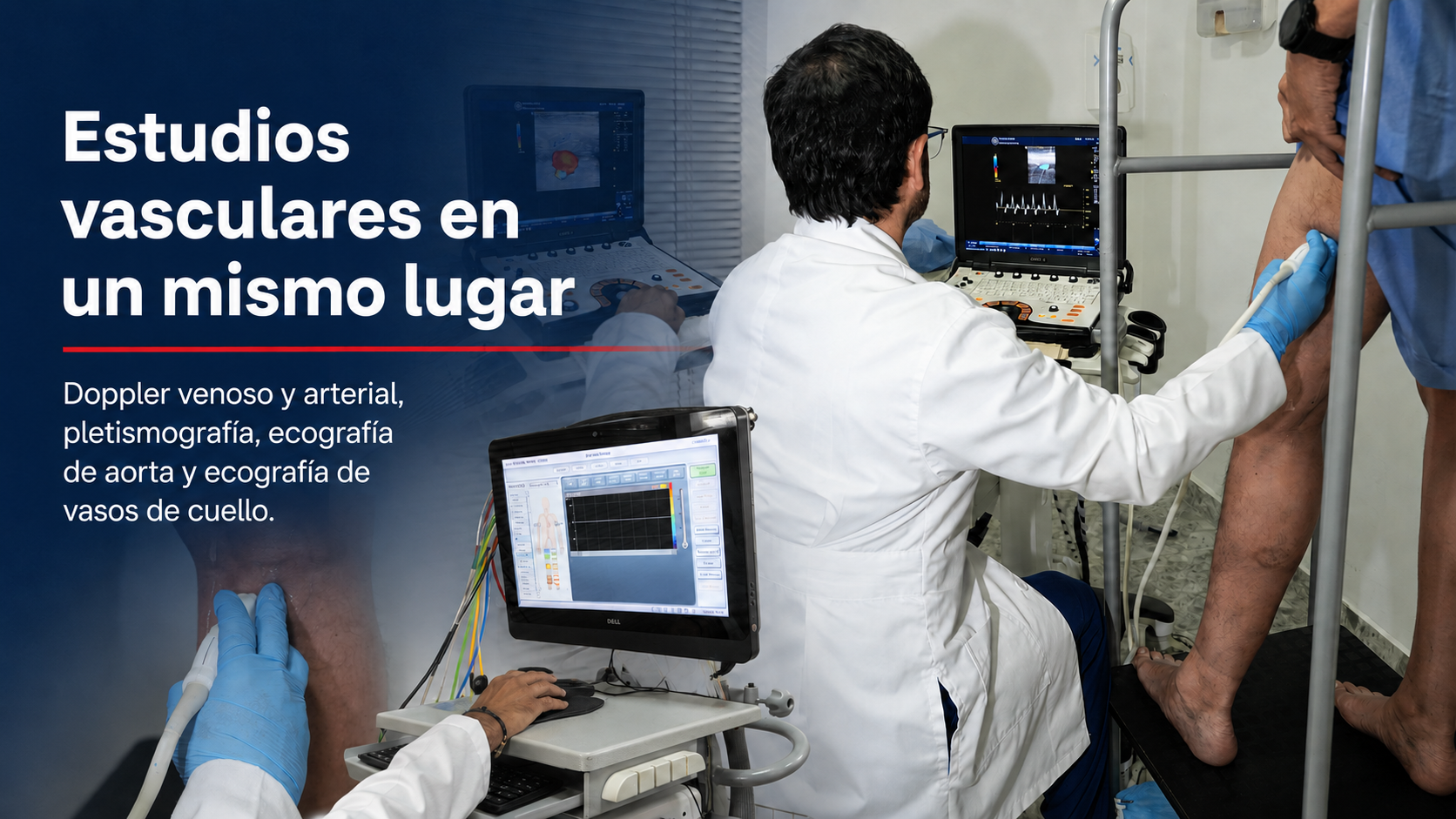 Estudios vasculares con Doppler, pletismografía y ecografía